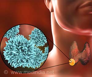 Increased Cancer Death Risk Following Treatment for Hyperthyroidism Increased Cancer Death Risk Following Treatment for Hyperthyroidism