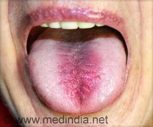 Burning Mouth Syndrome Needs More Rigorous Standards When Diagnosing Burning Mouth Syndrome Needs More Rigorous Standards When Diagnosing