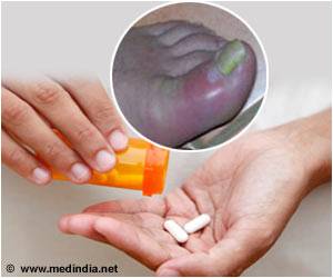 Opioids Prescribed More for Gout Patients: Study Opioids Prescribed More for Gout Patients: Study