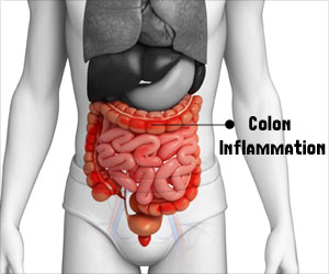 Drug Found to Increase the Risk of Inflammatory Bowel Disease Drug Found to Increase the Risk of Inflammatory Bowel Disease