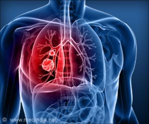 Scientists Learn How Lung Cancer Cells Spread Scientists Learn How Lung Cancer Cells Spread