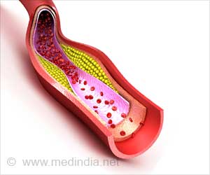 New Approach to Promote Self-healing After Heart Attack Developed New Approach to Promote Self-healing After Heart Attack Developed