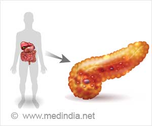 Diabetic Obese Patients can Undergo Pancreas Transplantation Robotically Diabetic Obese Patients can Undergo Pancreas Transplantation Robotically
