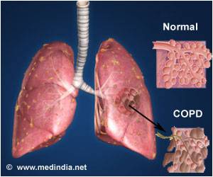 Finger-prick Test Decrease Antibiotic Use in COPD Patients Finger-prick Test Decrease Antibiotic Use in COPD Patients