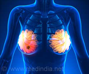 Artificial Intelligence can be Used to Diagnose Breast Cancer Accurately Artificial Intelligence can be Used to Diagnose Breast Cancer Accurately
