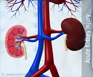 New AI Could Recognize Kidney Injury in Burn Victims New AI Could Recognize Kidney Injury in Burn Victims