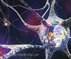 Cerebrospinal Fluid Differences to be the Key to Drugs in MS patients Cerebrospinal Fluid Differences to be the Key to Drugs in MS patients