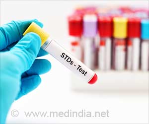 More Than 1 Million New Curable Sexually Transmitted Infections Every Day: Study More Than 1 Million New Curable Sexually Transmitted Infections Every Day: Study