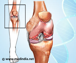 Septic Arthritis Outbreak: Multiple Injection Safety Violations Found in New Jersey Septic Arthritis Outbreak: Multiple Injection Safety Violations Found in New Jersey