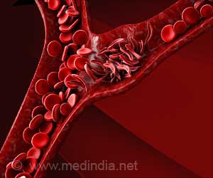 P38 Protein Controls the Formation of New Blood Vessels: Study P38 Protein Controls the Formation of New Blood Vessels: Study