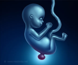 Babies Of Women Taking Dolutegrav Have High Risk of Neural Tube Defects Babies Of Women Taking Dolutegrav Have High Risk of Neural Tube Defects