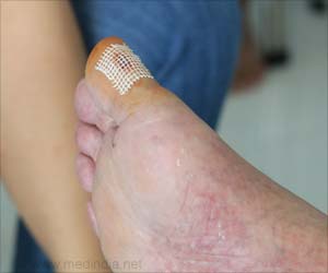 Enzyme for Normal Wound Healing in Diabetics Enzyme for Normal Wound Healing in Diabetics