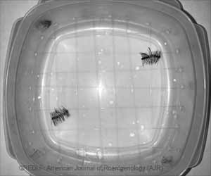 Magnetic Eyelashes: New Insights Magnetic Eyelashes: New Insights