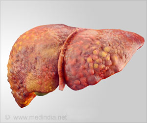 Lead Toxicity Promotes Fat Accumulation in the Liver: IIT Study Lead Toxicity Promotes Fat Accumulation in the Liver: IIT Study