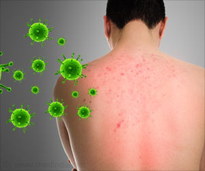 Skin Nerves also Play a Key Role in Fighting Infections