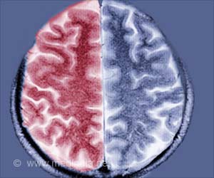 Six New Encephalitis Cases Reported from Bihar's Muzaffarpur Six New Encephalitis Cases Reported from Bihar's Muzaffarpur