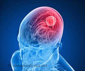 New Breast Cancer Drug may Treat Glioblastoma New Breast Cancer Drug may Treat Glioblastoma