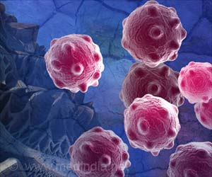 Inherited BRCA2 Mutations Tied to Increased Risk of Childhood Lymphoma Inherited BRCA2 Mutations Tied to Increased Risk of Childhood Lymphoma