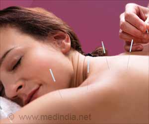 Acupuncture as Added Treatment for Chronic Stable Angina Acupuncture as Added Treatment for Chronic Stable Angina