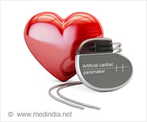 Wide Variation among Hospitals in Complications after Cardiac e-Device Wide Variation among Hospitals in Complications after Cardiac e-Device
