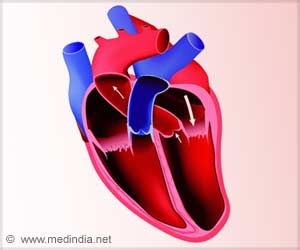 NHS Health Checks Cut Heart Disease Risk NHS Health Checks Cut Heart Disease Risk