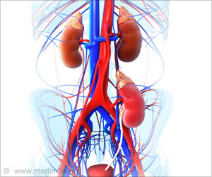 Pre-eclampsia Increases Risk of End Stage Kidney Disease Pre-eclampsia Increases Risk of End Stage Kidney Disease