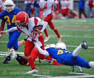 Repercussions of a Side Hit to the Head are Concussions, Brain Damage Repercussions of a Side Hit to the Head are Concussions, Brain Damage