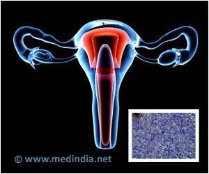 Single Test to Predict Pre-cancerous Cervical Disease Developed Single Test to Predict Pre-cancerous Cervical Disease Developed