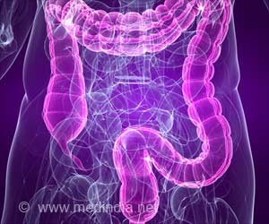 Edinburgh Has the Highest Universal Rate of Inflammatory Bowel Disease Edinburgh Has the Highest Universal Rate of Inflammatory Bowel Disease