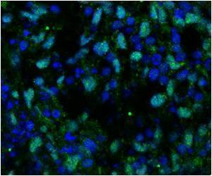 Power of New Stem Cell Combination in Treating Heart Diseases Power of New Stem Cell Combination in Treating Heart Diseases