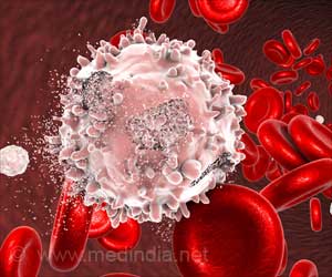 Combination Therapy Holds Promise for Infants With Deadly Leukemia Combination Therapy Holds Promise for Infants With Deadly Leukemia