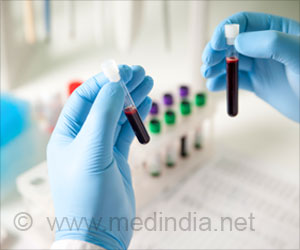 Lung Lining Fluid Key to Elderly Susceptibility to Tuberculosis Disease: Study