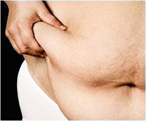 Noninvasive Neuromodulation Treats Obesity Noninvasive Neuromodulation Treats Obesity