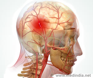 IIT Hyderabad Launches Medical Device for Stroke Victims IIT Hyderabad Launches Medical Device for Stroke Victims