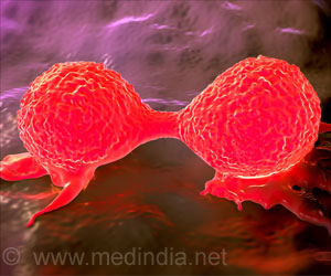 New Way to Hinder Spread of Breast Cancer Cells Discovered New Way to Hinder Spread of Breast Cancer Cells Discovered