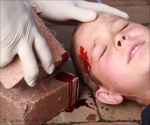 Childhood Accidents Can Be Prevented Through Psychology Childhood Accidents Can Be Prevented Through Psychology