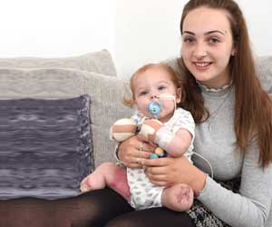 Baby Loses All Four Limbs to Throat Infection That Turned to Sepsis Baby Loses All Four Limbs to Throat Infection That Turned to Sepsis