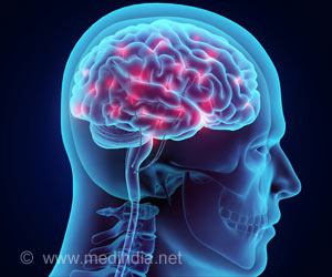 Manganese Affects Teens Cognitive Ability Manganese Affects Teens Cognitive Ability