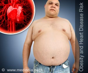 Ultrasound Therapy Soon Could Treat Cardiovascular Diseases Ultrasound Therapy Soon Could Treat Cardiovascular Diseases