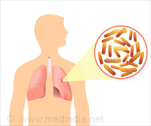 Cystic Fibrosis Can Be Diagnosed Using New Intra-nasal Imaging Technology Cystic Fibrosis Can Be Diagnosed Using New Intra-nasal Imaging Technology
