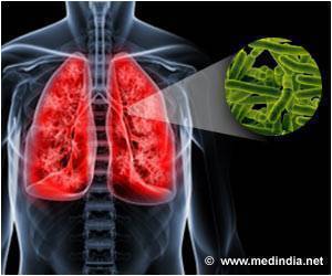 Unique Antacid Helps Tuberculosis Bacteria to Survive Unique Antacid Helps Tuberculosis Bacteria to Survive
