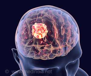 Aggressive Brain Tumor Could be Diagnosed Using Simple Blood Test in Future Aggressive Brain Tumor Could be Diagnosed Using Simple Blood Test in Future