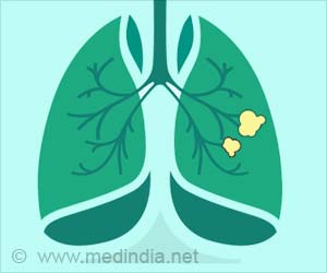 Dacomitinib in Advanced Lung Cancer: Risks Outweigh Survival Benefit Dacomitinib in Advanced Lung Cancer: Risks Outweigh Survival Benefit