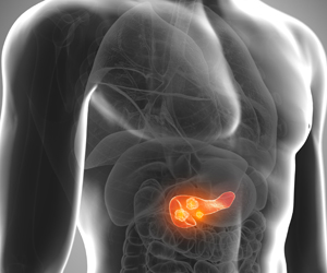 Combination of Targeted Therapies to Treat Pancreatic Cancer Combination of Targeted Therapies to Treat Pancreatic Cancer