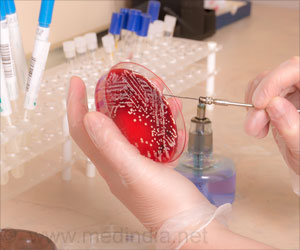 E. Coli's Secret Weapon in Launching Infections Revealed E. Coli's Secret Weapon in Launching Infections Revealed