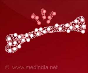 New Hydrogels Show Promise in Treating Bone Defects: Study New Hydrogels Show Promise in Treating Bone Defects: Study