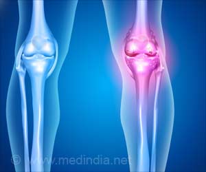 The Urinary Catheter No Longer Needed for Joint Replacement Surgery The Urinary Catheter No Longer Needed for Joint Replacement Surgery