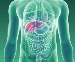 Stress Enzyme Linked to Liver Cancer Growth Stress Enzyme Linked to Liver Cancer Growth