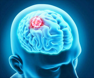 Unique Pathway for Treating Deadly Children's Brain Cancer Identified Unique Pathway for Treating Deadly Children's Brain Cancer Identified