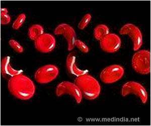 Computer Model Could Be Used To Test New Sickle Cell Medications Computer Model Could Be Used To Test New Sickle Cell Medications